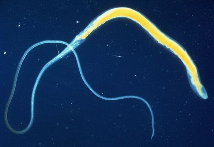 El tricocéfalo es un parásito intestinal común.