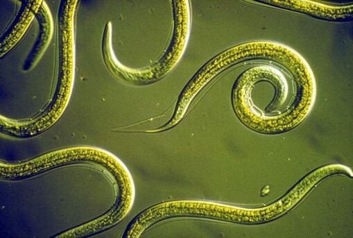 Lombrices intestinales parásitas que viven en el intestino delgado humano.