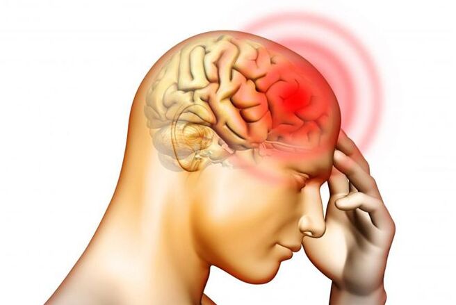 Los dolores de cabeza pueden ser un síntoma de la presencia de larvas de ascárides en el oído medio.